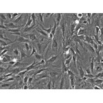 Rat Mesenchymal Stem Cells - Bone Marrow (RMSC-bm)